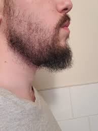 The hair that appears on the face is basically a response to the presence of androgens. 29 Cheek Hair Too Thin All Around Too Patchy What To Do Not Sure If I Should Even Keep The Beard Or Not Album On Imgur