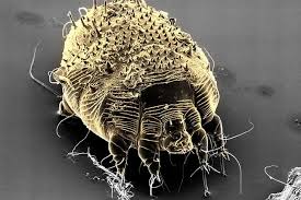 Image result for scabies symptoms
