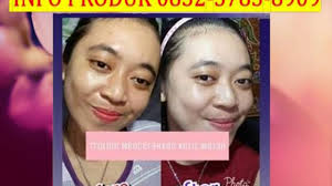 Trulum skin care (jujur tanpa rekayasa). Harga Trulum Skincare Synergy Indonesia Review Manado Youtube