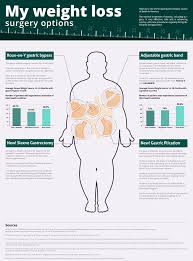 Pin On Weight Loss Surgery Stuff