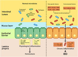 Frontiers Interactions Between Intestinal Microbiota And Host Immune Response In Inflammatory Bowel Disease Immunology