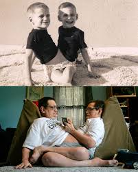 Longest living conjoined twins in history