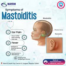 Image result for Mastoiditis