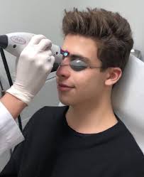 How to Get Rid of Acne With Lasers