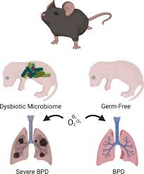 Mice without a microbiome are partially protected from lung injury by  hyperoxia