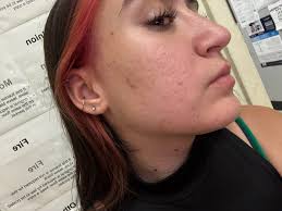 How do you say glowy, smoother skin? BAKUCHIOL! ✨ It's retinol but  better!🌻🌟 Glow up the natural and gentler way with the power of Sunflower  Beauty Oil enriched with the benefits of