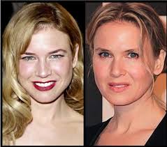 Renee Zellweger Plastic Surgery Denied Renee Zellweger Plastic Surgery Before After Plastic Surgery Before A Renee Zellweger Plastic Surgery Cosmetic Surgery