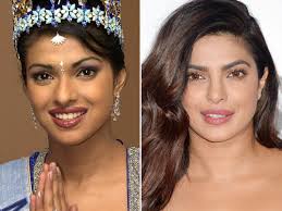 Priyanka Chopra Before And After Celebrities Before And After Nose Job Plastic Surgery 10 bollywood celebrities plastic surgery disasters: