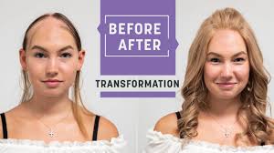 Alopecia areata and hair dye. Alopecia Areata A Wig For A 13 Year Old Transformation With Hey2go Wig Hairsystems Heydecke Youtube