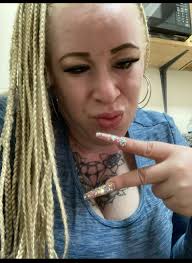 Photoshop requests for albinism portraits