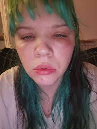 Does anyone know of a specialist in the UK that tests for and treats  chemical sensitivity/allergy. After recent exposure to a fragrance that has  left me feeling very unwell for a few