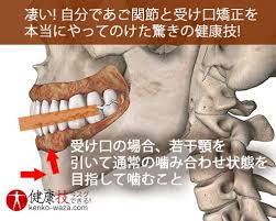 凄い 自分であご関節と受け口矯正を本当にやってのけた健康技9 health fitness kenko medical