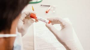 Schnelltest ergebnis in 20 min; Dutch Startup Virotact Secures Funding For Covid 19 Test That Can Detect Virus In 30 Seconds Mobihealthnews
