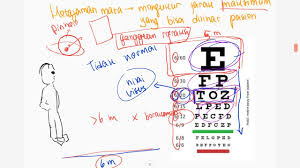 This mhealth application intent is to provide and empower mobile regular users and health professionals with the. Visus 60 Conjecturalist Itisalwaysdoom Site