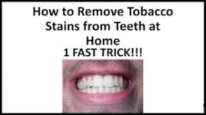 It is a natural antibiotic and teeth/gum cleanser and is a good way to remove cigarette stains. How To Remove Tobacco Stains From Teeth At Home 1 Fast Trick Youtube
