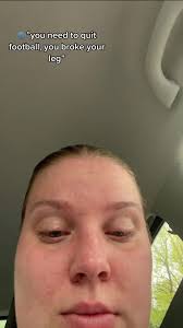 Soccer Injury Leg Ripped Open