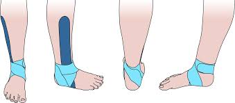 This may sound like overkill for a flat structure that supports your weight, but you may not realize how much work your foot does! Immediate Effect Of Kinesiology Tape On Ankle Stability Bmj Open Sport Exercise Medicine