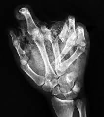 Pin On X Rays