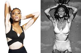 Check spelling or type a new query. Model With Rare Skin Disease Changing The Face Of Fashion