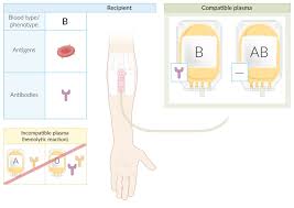 Image result for Plasma Transfusion