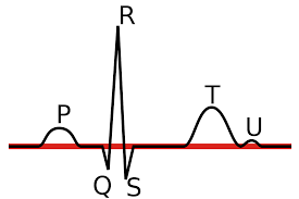 It is a graph of voltage versus time of the electrical activity of the heart using electrodes placed on the skin. File Linia Izoelektryczna Ekg Svg Wikimedia Commons