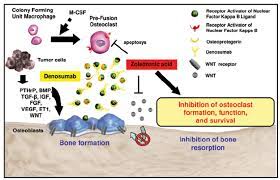 I just started on zytiga and zometa, as psa has risen, after lupron / bicalutamide is no longer effective. Possible Mechanism Of Action Of Zoledronic Acid And Denosumab Download Scientific Diagram