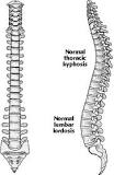 Image result for icd-10 code for scoliosis thoracolumbar region