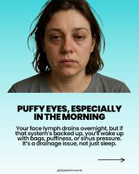 Had lymphatic drainage done for the first time today, and man do I feel  nauseous and a little crummy. Has anyone else experienced this or is it all  in my head 🫠🤪