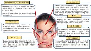 Acne Chart Usdchfchart Com