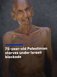 Crisis in Gaza: Salim Ibrahim's Struggle with Hunger