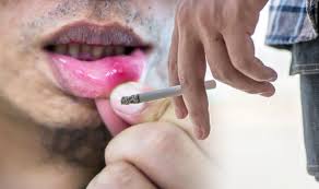 Health scotland and glasgow dental hospital. Mouth Cancer Symptoms Pain In The Mouth And Ulcers Five Signs You Have This Cancer Express Co Uk