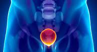 Being a male age 20 to 35 3. Urethritis Causes Treatment Prevention
