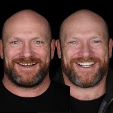 Before & After Gallery