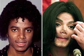 25 Most Expensive Celebrity Plastic Surgeries Celebrity Plastic Surgery Bad Plastic Surgeries Plastic Surgery
