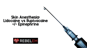 How long does a case of coronavirus last? Skin Anesthesia Lidocaine Vs Bupivacaine Epinephrine Rebel Em Emergency Medicine Blog