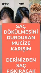 sac dokulmesine mucize cozum sac dokulme tedavileri sac sac dokulmesi