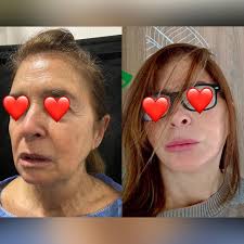 Dr. Esteban Blanco (@drblanco_e) • Instagram photos and videos