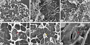 Image result for Acacia rovumae