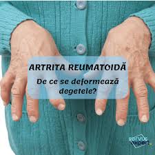 Pacientul trebuie să viziteze medicul cel puțin o dată la 3 luni la începutul tratamentului. Artrita Reumatoida Account Options