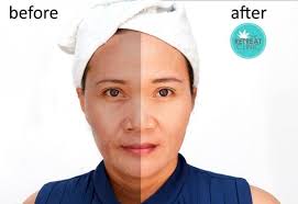 Hospital umra seksyen 13 shah alam. The Retreat Clinic Setia Alam Hq Aesthetics Physician In Shah Alam