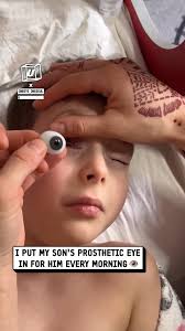 Sneezed so hard I thought his eye would launch 😅👁️💨