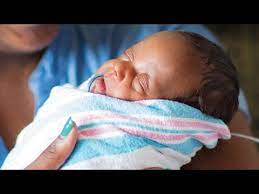 For example, if your baby is 10 weeks old, but was born 6 weeks early, subtract 6 from 10. Niccu Nicu Baby Born 10 Weeks Early Grows Stronger Live L A Give L A Youtube