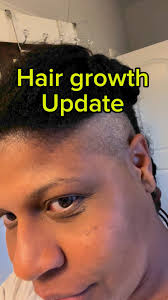 Products available at www.Enjoy-Natural.com #viral #hairgrowthoil