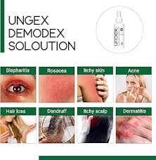 Image result for demodex rosacea