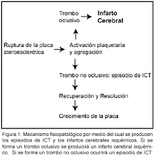 La edad es importante pero no definitiva, aunque la. Isquemia Cerebral Transitoria Y Riesgo De Infarto Cerebral Isquemico