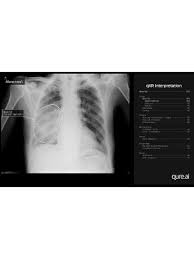 Image result for XRay Interpretation