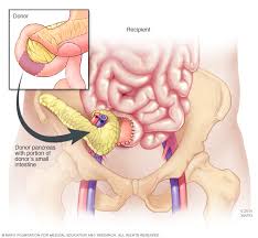 Image result for pancreas)