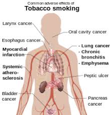 Tobacco Smoking Wikipedia