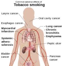 Tobacco Smoking Wikipedia