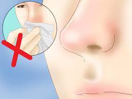 It can be caused by colder outdoor temperatures, or by the cold, flu, or allergies. How To Prevent A Runny Nose In Cold Weather 8 Steps